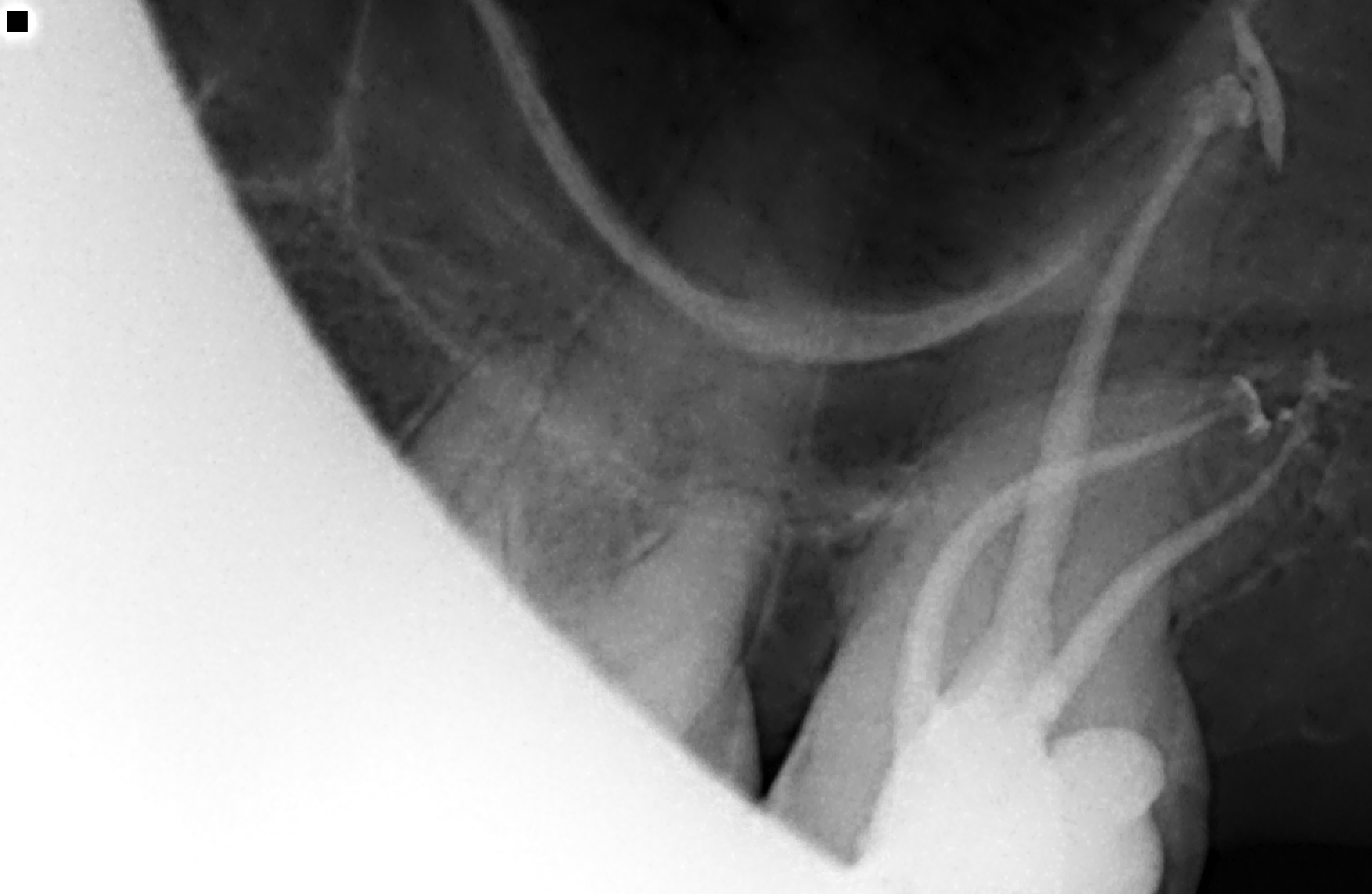 Endodonzia - Studio Dentistico 2M