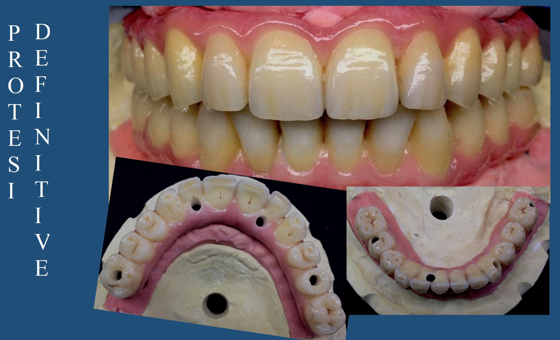 Protesi Dentale - Studio Dentistico 2M